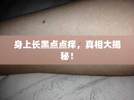 身上长黑点点痒,真相大揭秘!